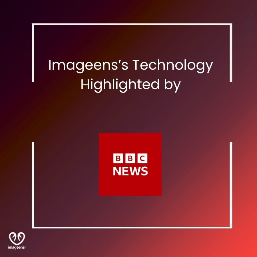 Imageens technology highlighted by BBC News 